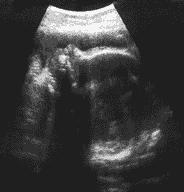 Lull Overcome rape 35 nėštumo savaitė – Nėštumo kalendorius
